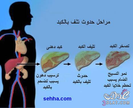 لعلاج امراض وتلف الكبد