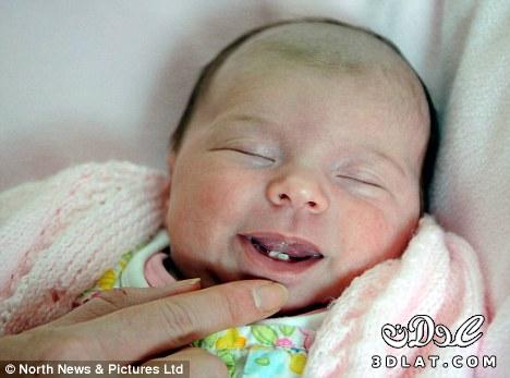 ولادة طفلة بريطانية لديها "سنتين" بفمها