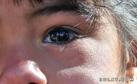 طفلة هندية تبكي حجارة بدلاً من الدموع