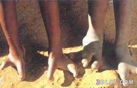قبيله في إفريقيا يملكون أقدام غريبه
