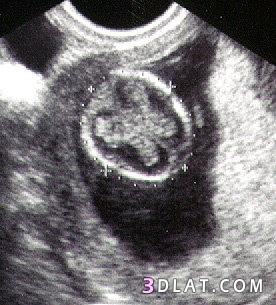 رد: مراحل تطور الجنين داخل بطن أمه بالصور