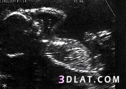 رد: مراحل تطور الجنين داخل بطن أمه بالصور