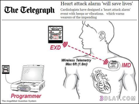 جهاز إنذار يحذر من النوبة القلبية - شاهدوا الصورة