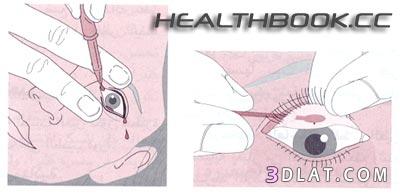 طريقة إزالة القذاة من العين