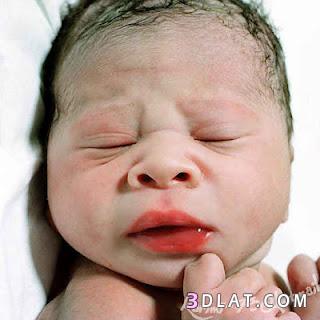 الولادة القيصرية راحة للام وتعب للطفل