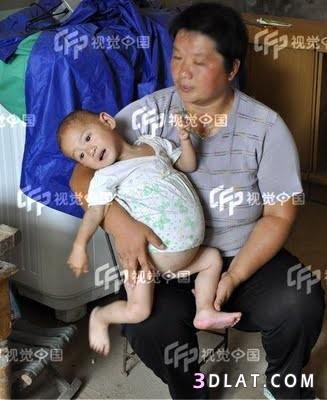 طفلة صينية حامل باخيها التؤام