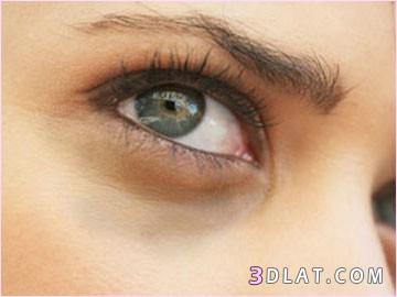 اسباب ظهور الهالات السوداء تحت العين والوصفات الطبعية لعلاجها