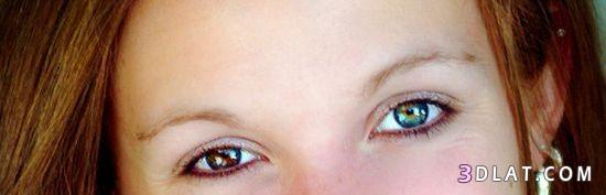 اسباب اختلاف لون العين عند الانسان 2024