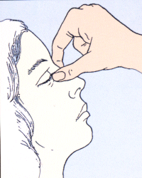 كيفية استخدام قطرات العين بالصور،ارشادات وضع قطرات العيون،لعلاج امراض العيون