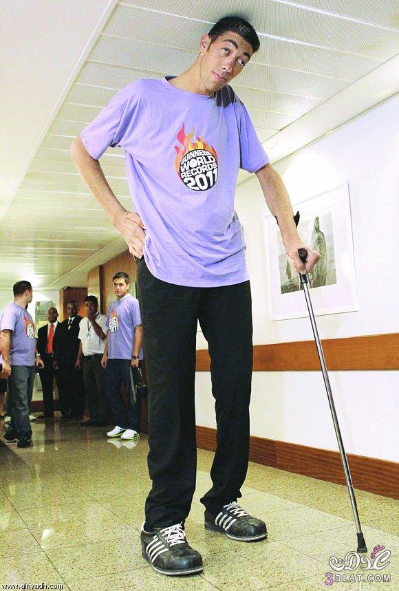أطول رجل في العالم تركي طوله 47. 2 متر