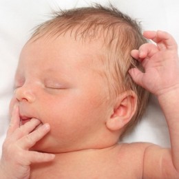 الصفار عند الاطفال حديثي الولاده وماهو علاجه ؟؟