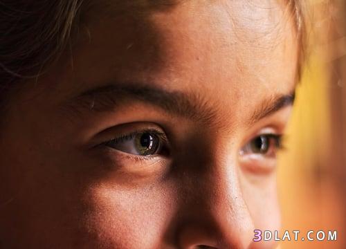 أمراض العيون الشائعة عند الأطفال وطرق علاجها ، واكتشافها ، أمراض العيون الش