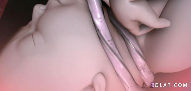 اسباب التفاف الحبل السري حول رقبه الجنين