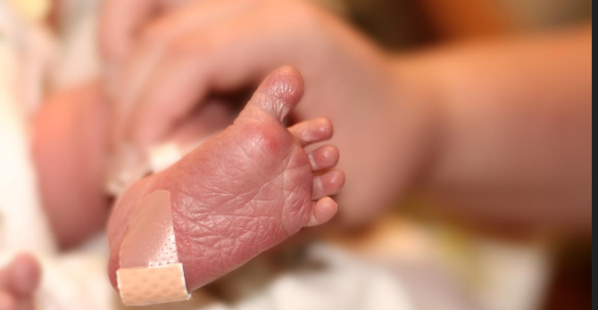 ما هوتحليل كعب قدم حديثي الولادة،أهمية تحليل كعب القدم للمولود ،أضرار إهمال