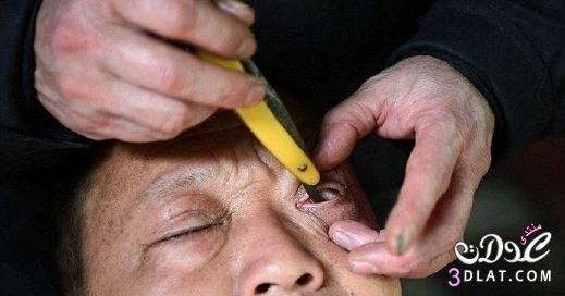 فن تنظيف العين بشفرة حادة في الصين
