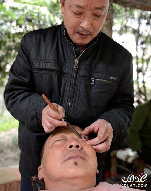 فن تنظيف العين بشفرة حادة في الصين