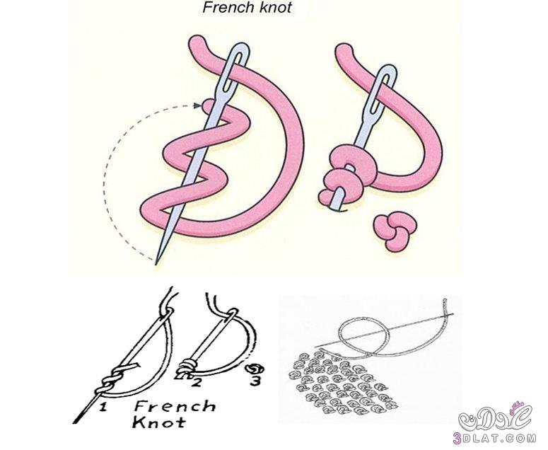 غرزة العقدة الفرنسية