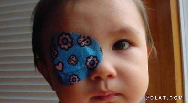 مواضيع تهمك  في العناية بطفلك ..تمارين العين الكسولة وكيفية تنشيطها للأطفال