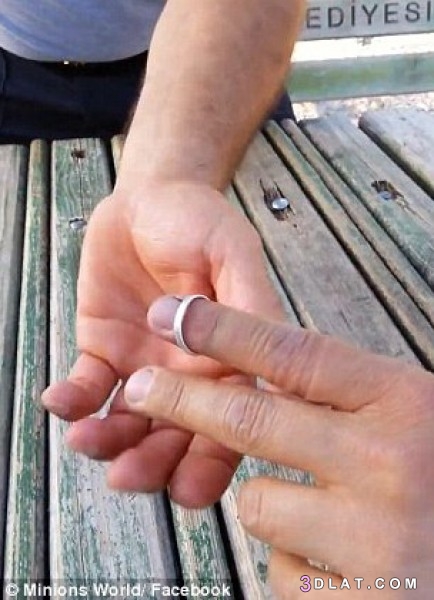 كيفية نزع خاتم ضيق كيف تُزيل "خاتم" عالق من أصبعك في دقيقة واحدة فقط دون أ