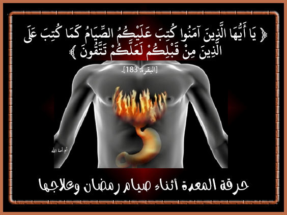 حرقة المعدة أثناء صيام رمضان وعلاجها، الحموضة في رمضان أسبابها وعلاجها،صيا