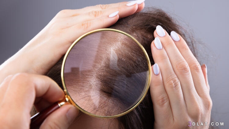 وصفات طبيعية تعمل على تحفيز نمو الشعر2024،اهم الاطعمة لنمو الشعر