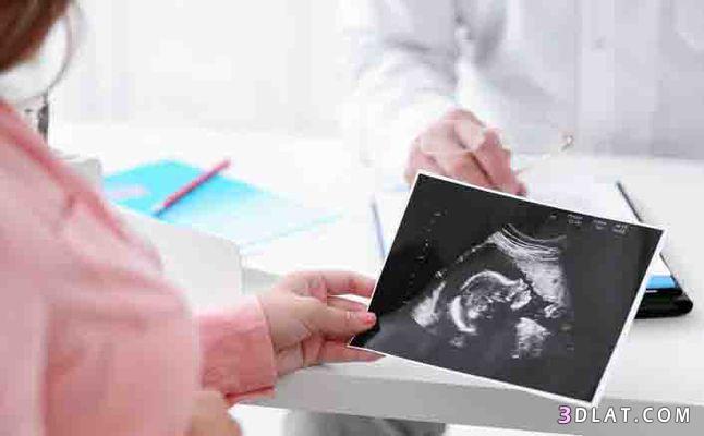 ما هي اول علامات الولادة, ماهى اعراض الولادة, تعرفى على اعراض الولادة