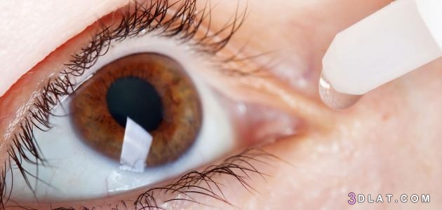 حساسية العين،أسباب حساسيّة العين،أعراض الإصابة بحساسية العين علاج حساسية ا