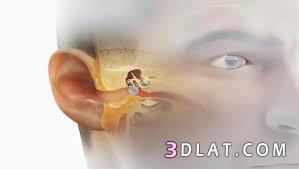 تمزق طبلة الأذن.وما هي أعراض حدوثه؟ وما الأسباب؟ وهل من طرق للوقاية منه