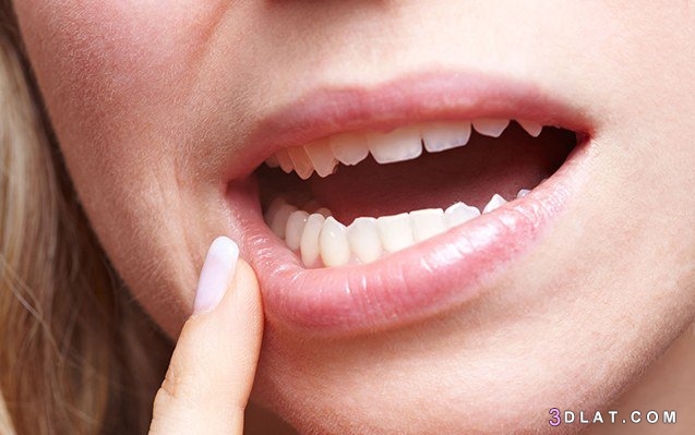 سبب جفاف الفم أثناء النوم ، أسباب جفاف الريق،علاج جفاف الفم  بالطرق الطبي