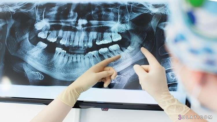 سبب مرض الزهايمر قد يعيش داخل فمك