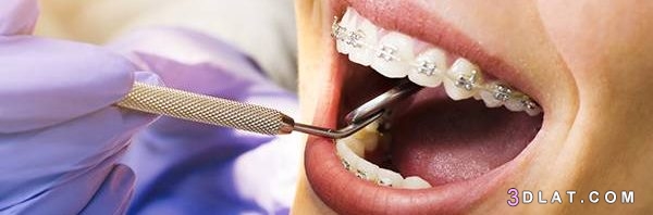 تقويم الأسنان، دواعي استعمال تقويم الأسنان طرق تقويم الأسنان كيف نتعامل مع