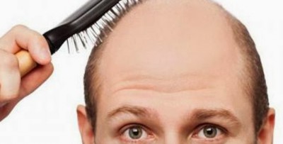 أدوية “واعدة” تنجح في علاج داء “ثعلبة” الرأس واستعادة الشعر