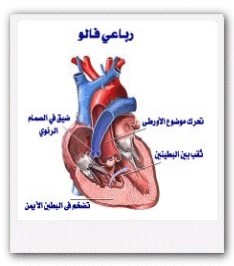 علاج ثقب القلب ,ملف كامل عن اسباب حدوث ثقب القلب عند الاطفال,ماهو القلب الازرق,العلاج