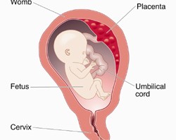 تسمم الحمل واعراضه,كيف يتم تشخيص تسمم الحمل,علاج لتسمم الحمل,ولادة طفلك