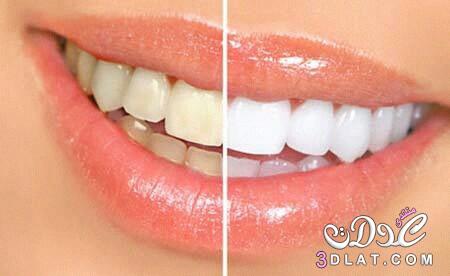 وصفات مجربة طبيعية لتبييض الاسنان والحصول على ابتسامة جذابة