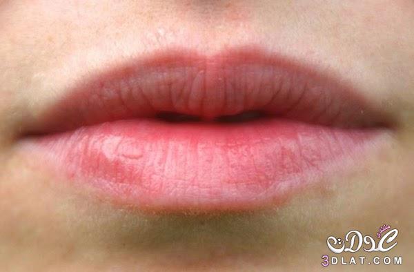 أهم 5 خلطات لتفتيح المنطقة حول الفم,طرق طبيعيه لمعالجه الاسمرار حول الفم
