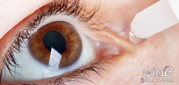 العلاجات المنزلية لحرقة العين من الحساسية, طرق منزلية لعلاج حرقة العين من الحساسية,