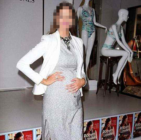 عارضة أزياء تجهض طفلها في شهرها الثامن للحفاظ على رشاقتها