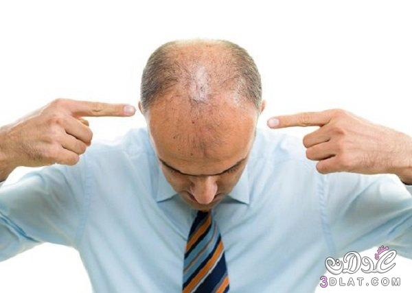 ماهو علاج الشعر الخفيف من الامام ؟