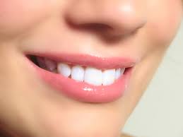 مشروبات تسبب اصفرار الأسنان,تحذير: مشروبات وأطعمة تجعل ابتسامتك صفراء