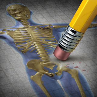 علاج هشاشة العظام هشاشة العظام وعلاجها ماعلاج هشاشة العظام