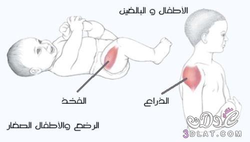 كيفية الحقن العضلي Intramuscular Injection
