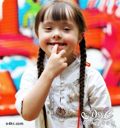 اعراض طفل الداون ( المنغولية ),ملف كامل عن اعراض طفل الداون ( المنغولية ),تعرفي علي